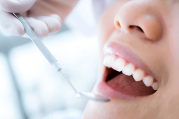 Preventive Dentistry - Professional Teeth Cleaning and Repair Services in Kuching